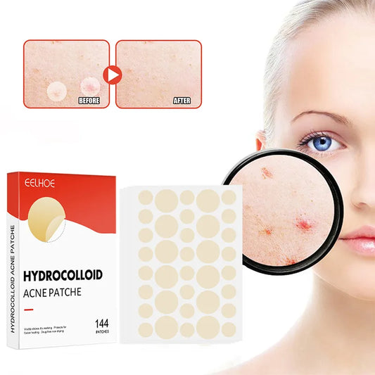 144pcs/set Face Skin Care Acne Pimple Patch 2 Sizes Invisible
